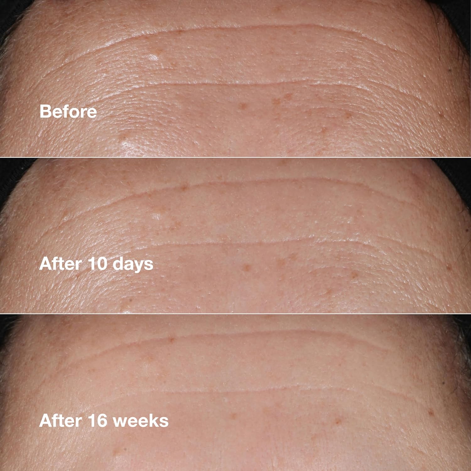 Ultimate Guide to Clinique Smart Clinical Repair Wrinkle Corrector 4 ultimate guide to clinique smart clinical repair wrinkle corrector - image 4